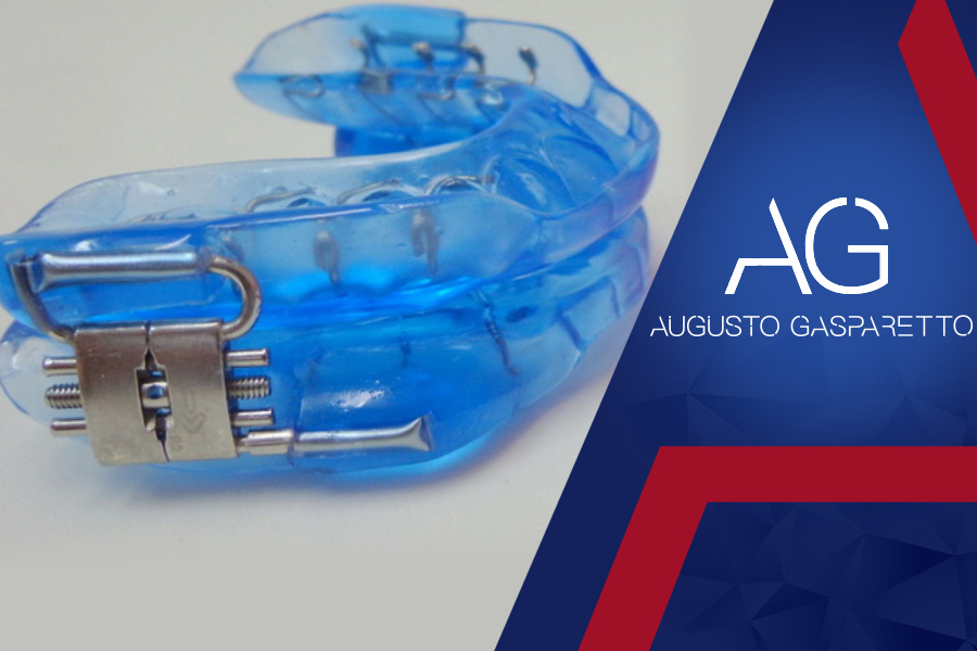 Aparelho Intra-Bucal