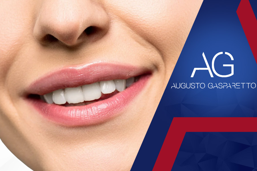 Como é feito o clareamento dental?
