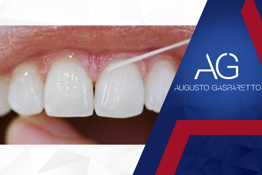 FIO DENTAL