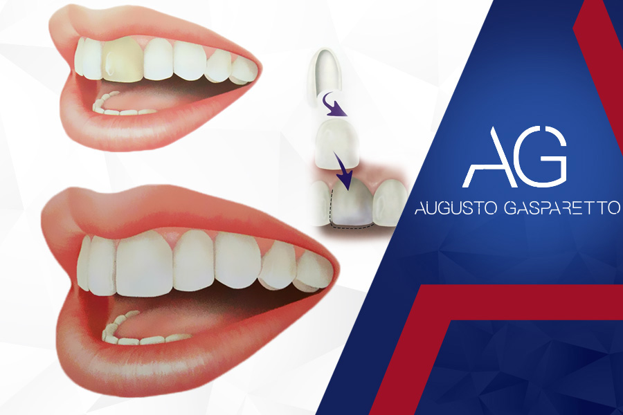 Estética Dental