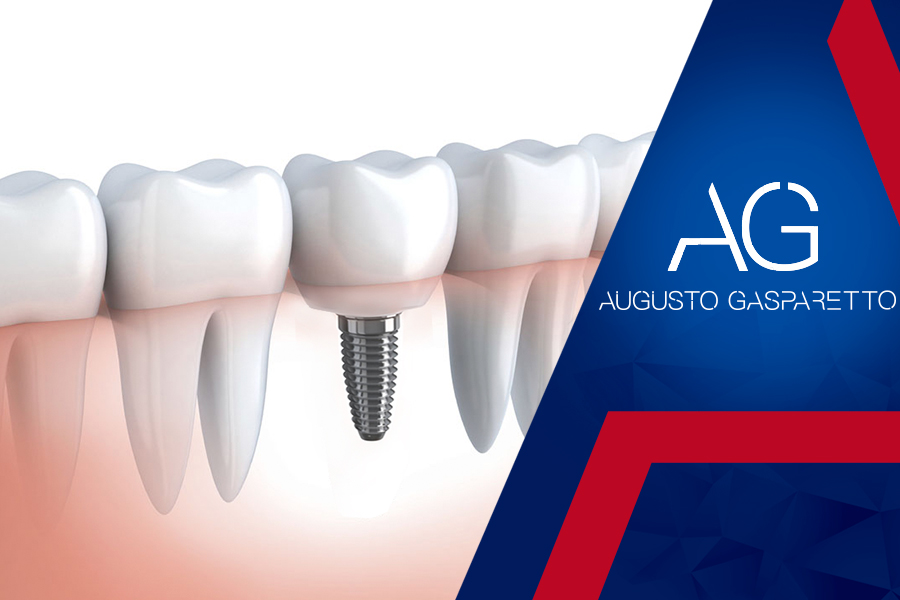 Implantes